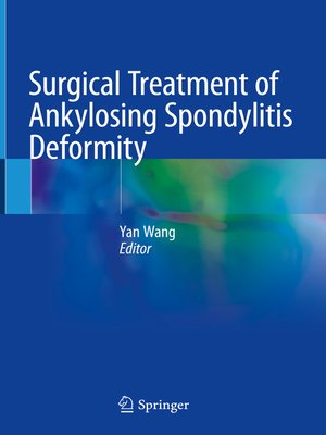 cover image of Surgical Treatment of Ankylosing Spondylitis Deformity